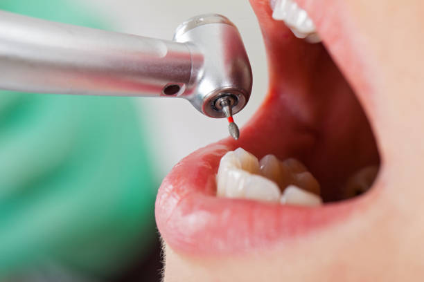 Best Knocked-Out Tooth Emergency  in Church Hill, MD